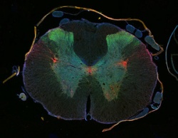 Cross section of rat spinal cord with immunostaining: axons (red), synapses...