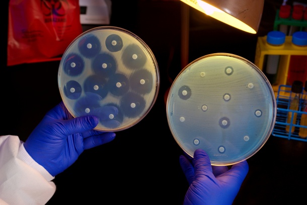 Two plates growing bacteria in the presence of discs containing various...