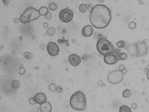 Intestinalorganoids.