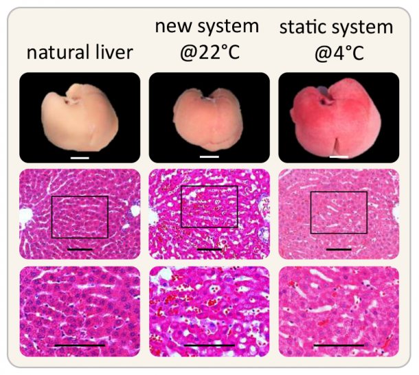 A natural liver (left column), a liver preserved using the new perfusion system...