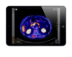 iPad mini mit radiologischen Bilddaten des Gehirns.