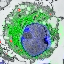 Aufnahme einer dendritischen Zelle: Mit einer speziellen Mikroskopietechnik...