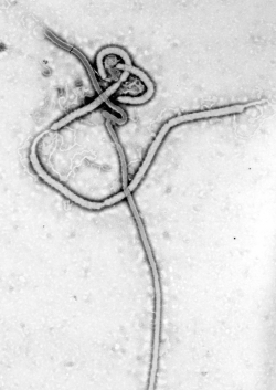 Zaire ebolavirus