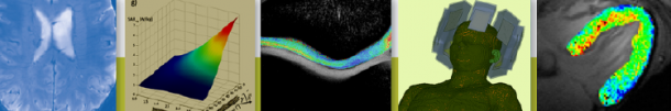 Photo: Ultrahigh Field MR: Cutting Edge Technologies Meet Clinical Practice