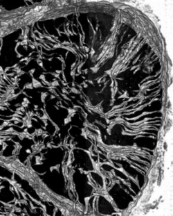 Part of a healthy heart cell with a t-tubule ‘bicycle spoke’ structure.