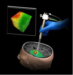 An illustration of a new technique using Optical Coherence Tomography that...