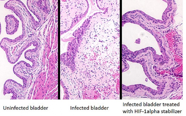 Abundance of bacteria in the opening of a mouse bladder (center) is...