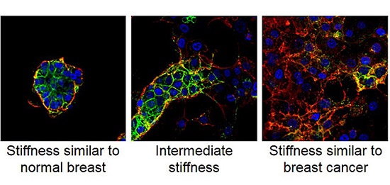 In stiffness levels similar to breast cancer (right), cells are better able to...