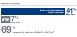 An international multi-center 185-patient tandem study reported in the Lancet...