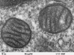 Elektronenmikroskopische Aufnahme von Mitochondrien.