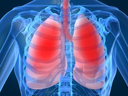 Bei Lungenkrebs ist die stereotaktische Bestrahlung auch im Frühstadium eine...