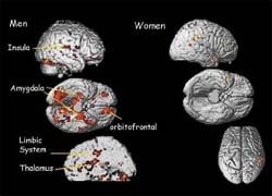 Fig. 1: For analysis of specific activation, the contrast images of all groups...