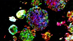 Lung stem cells (green and red) residing in a cultured lung spheroid.