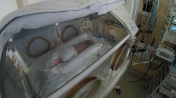 Premature baby in an incubator.