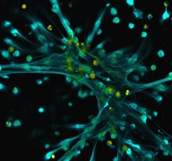 Neutrophils produce bacteria-ensnaring NETs (shown in blue/green) in response...