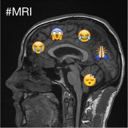 MRI of Johnathan Hewis brain: Had a lovely nap in the MRI machine (very...