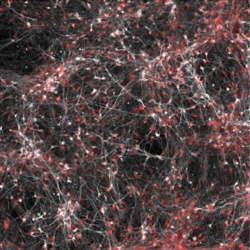 Salk scientists discover cellular differences between brain cells from bipolar...
