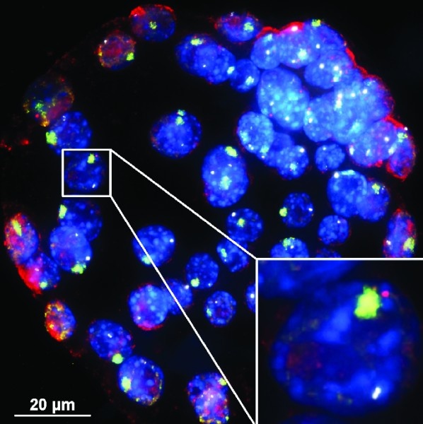 In these mouse embryo cells, XistAR RNA strands show up in red - and the Xist...