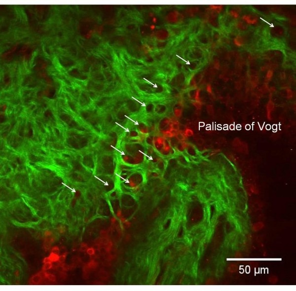 Newly discovered structures within the limbus, the transition zone between the...