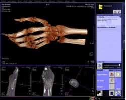 Now, for the first time, Multitom Rax makes it possible to take 3-D images...