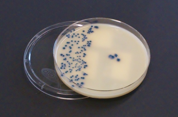 Carbapenemase-produzierende Enterobakterien (blau gefärbt) auf einer...