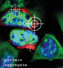 Damit Proteinaggregate (rot) in den Zellen unter dem Mikroskop sichtbar sind,...