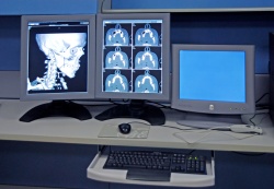 Photo: MRI technique offers faster diagnosis of multiple sclerosis