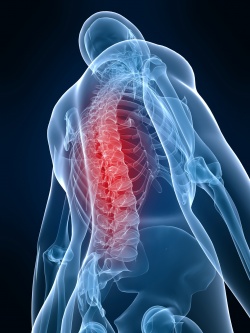 Elektrische Impulse aktivieren das Rückenmark unterhalb der Verletzung.