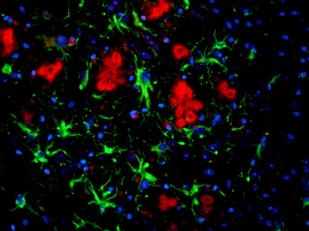 Das Foto zeigt einen gefärbten Dünnschnitt eines Mausgehirns: ß-Amyloid...