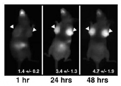 Photo: A pill could improve breast cancer diagnoses