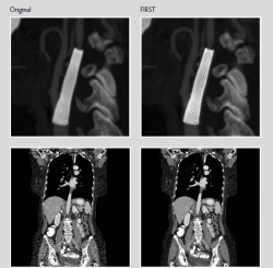 FIRST, with forward projection in the raw-data domain and using optical models...