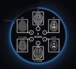 Conventional: Six scans for six contrasts.