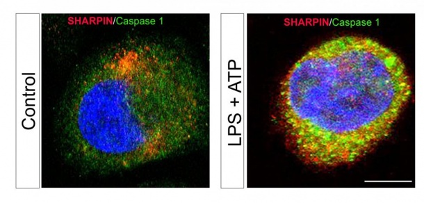 Confocal images of human monocytes immunostained with antibodies toward SHARPIN...