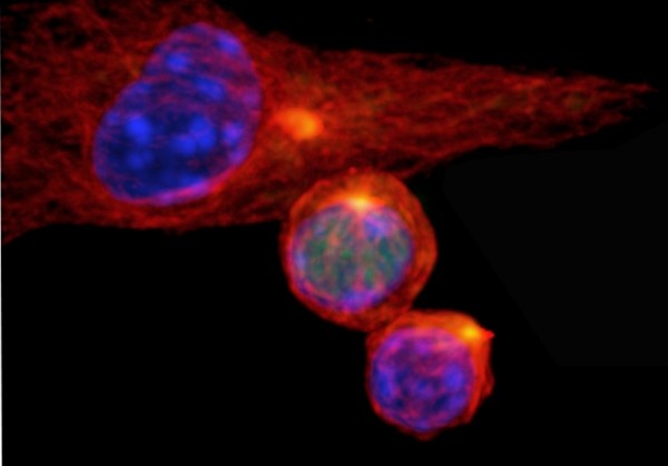 The fate of daughter T cells in the immune system (lower cells in image) is...