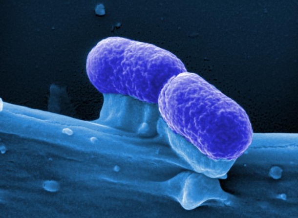 Probiotische E. coli-Bakterien könnten künftig als therapeutisches Mittel...