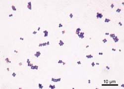 Staphylococcus aureus