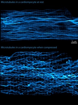 Photo: Molecular strut controlls mechanics of a heartbeat