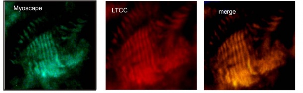 Fluorescently labelled antibodies show the exact localisation of Myoscape...