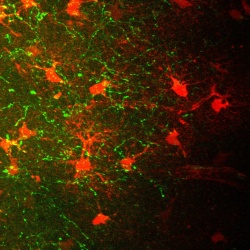Exposed to new sensations certain nerve cells, via their appendages (green in...