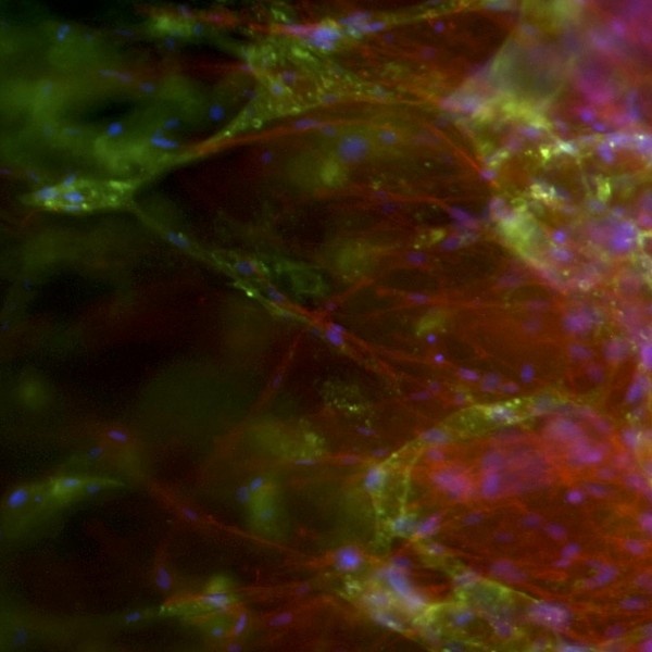 Lab-engineered human capillaries (in green) derived from stem cells are making...
