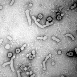Electron micrograph of HBV virions released from infected cells. (large ovals...