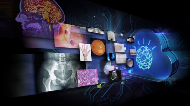 Photo: Agfa HealthCare collaborates with IBM to advance Cognitive Imaging