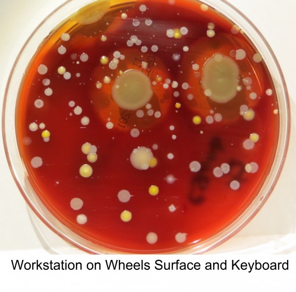 Photo: Yuck factor may boost hand hygiene compliance