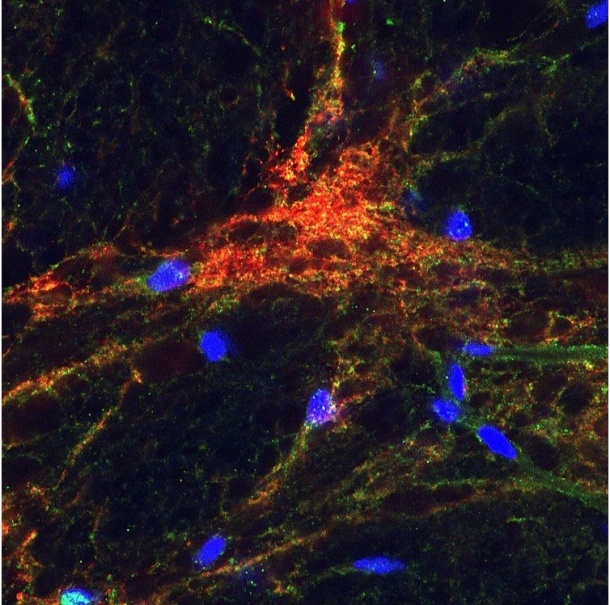 Gap junctions in den Basalganglien Zellkerne (blau), inhibitorische Neuronen...