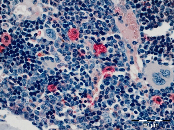 Blutbildende Zellen des Knochenmarks.