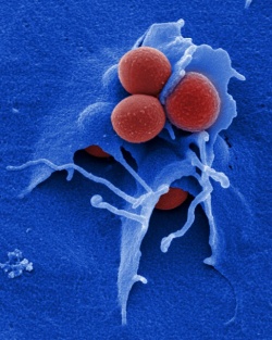 Das Bakterium Staphylococcus aureus (rot) bildet häufig Resistenzen gegen...