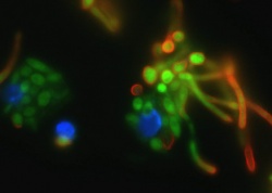 Candida albicans (green) is being eaten by a dentritic cell (blue).