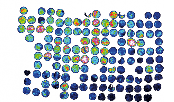 MALDI image of a tissue microarray. The MALDI Tissuetyper can analyze formalin...