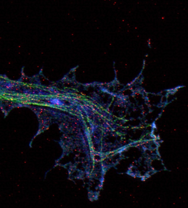 Hochauflösende Mikroskopie einer Axonterminale eines kultivierten Motoneurons:...