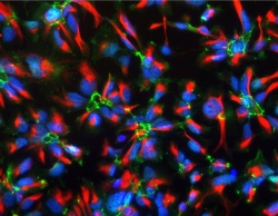 Das Mikroskopie-Bild zeigt humane neurale Stammzellen, bei der durch eine so...